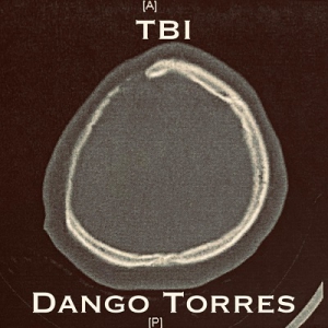  Dango Torres - TBI