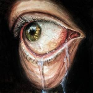 Prognoise - Lacrimal